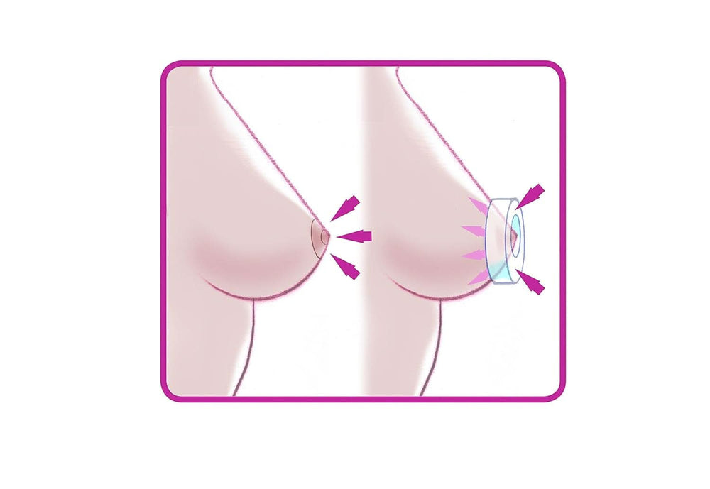 ELANEE Brust-Ringe, Schutz Der Brustwarze Bh-Kontakt Durch Hohllagerung, Ideal Bei Wunden, Entzündeten Brustwarzen Durch Stillen, 10 Stück (222-00) Akcesoria Żywność i karmienie piersią Sklep Bebe Naty