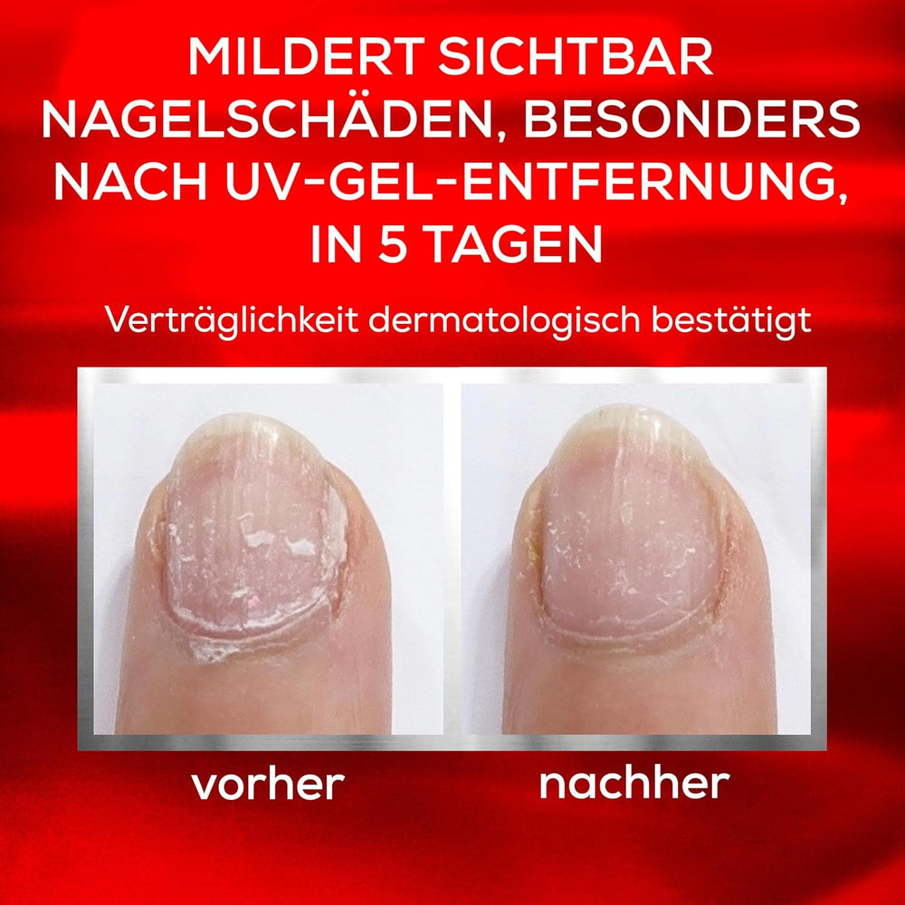 Zestaw Essie Nail Rescue: morelowy olejek do paznokci i skórek + naprawczy lakier do paznokci To the Rescue